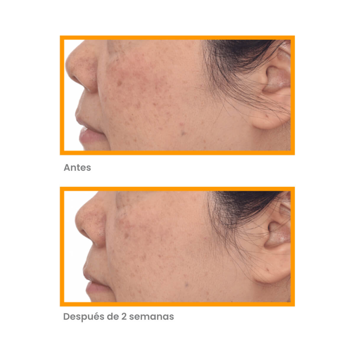 CORRECT & PROTECT SERUM SPF 45 (SUERO ANTIMANCHAS Y PROTECTOR SOLAR)